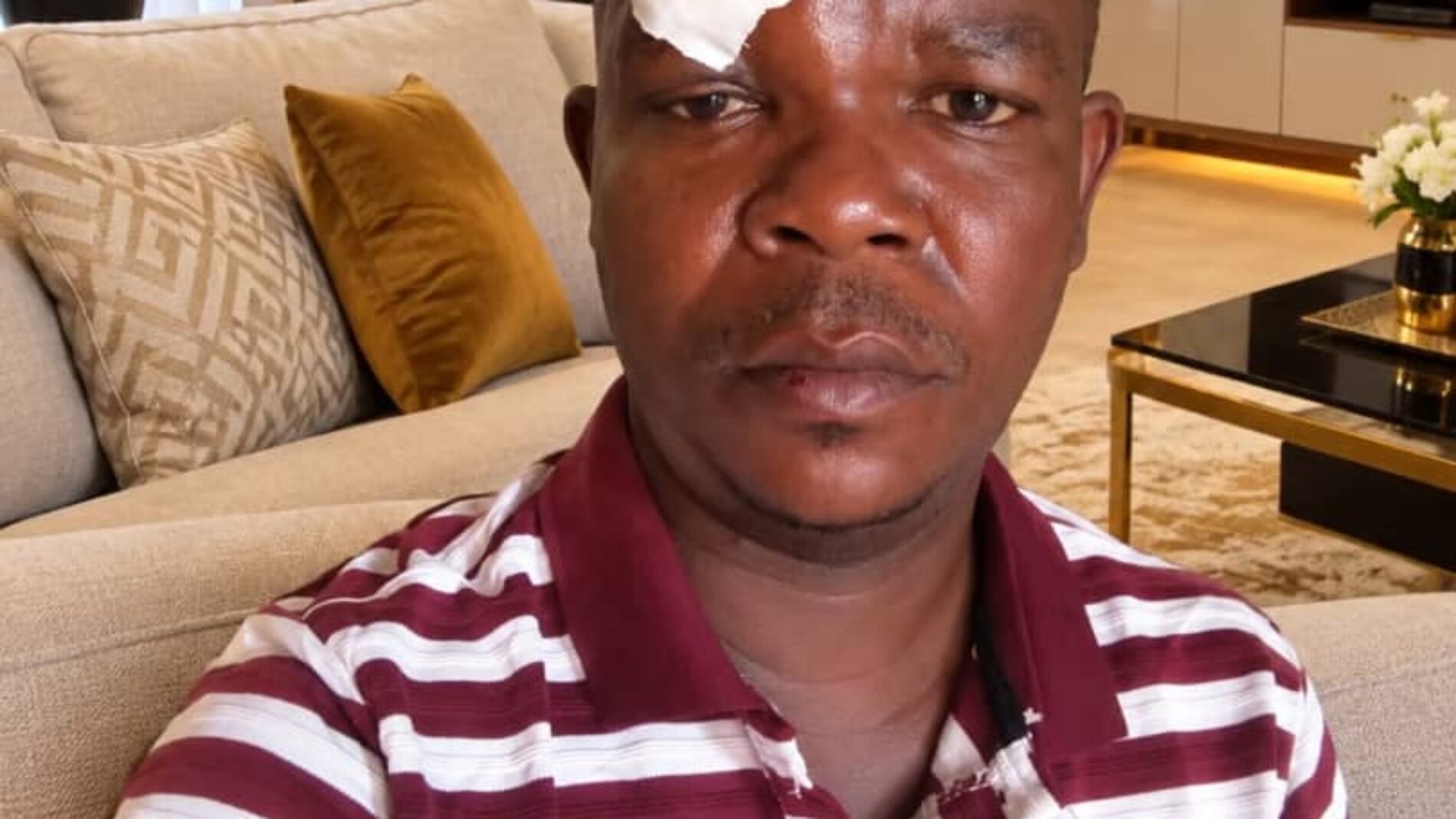 Journalist Kenny Claude Nduwimana Violently Assaulted in Bujumbura Amidst Ongoing Harassment