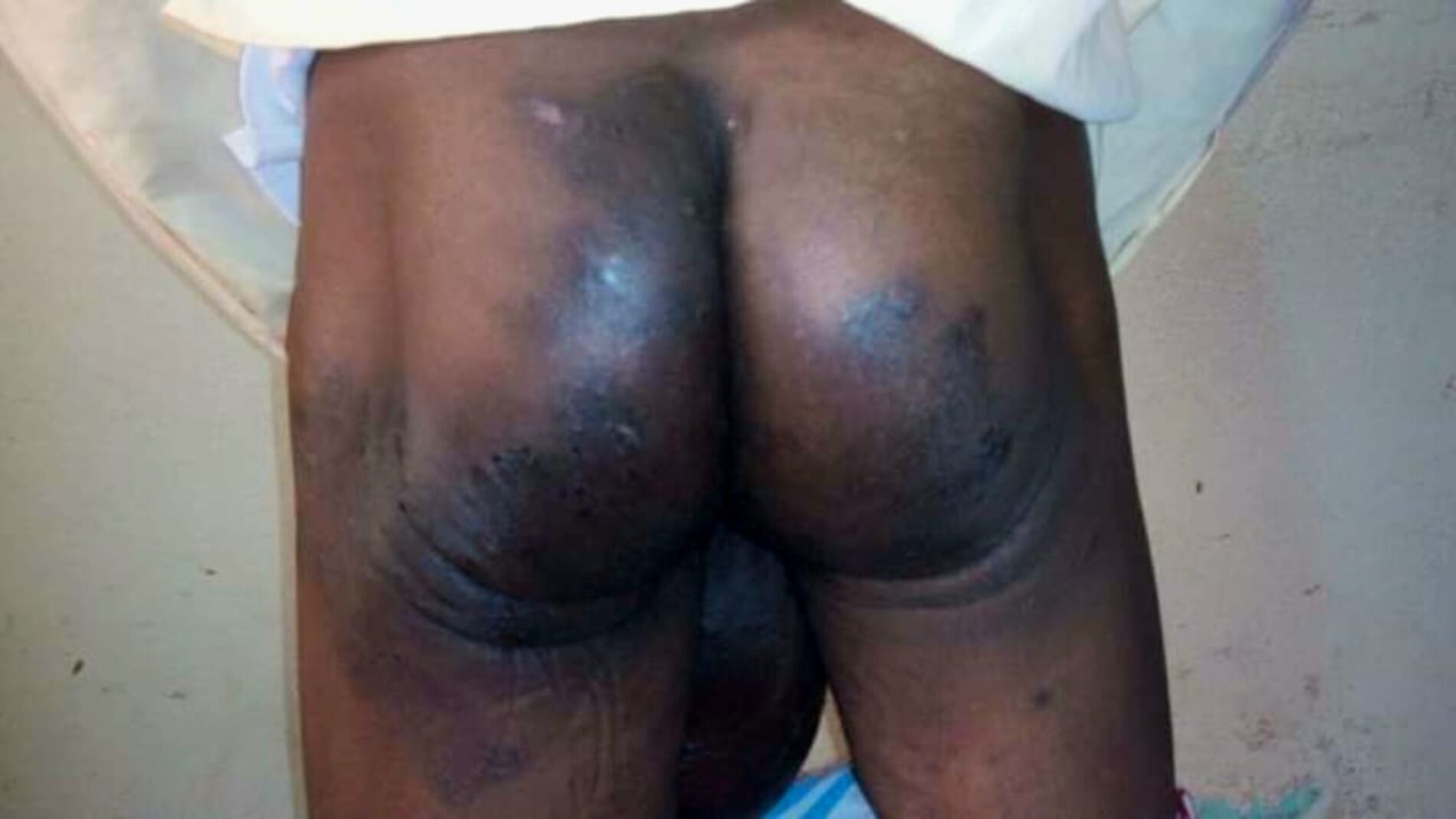 Ligue Iteka Report Details Severe Human Rights Deterioration in Burundi